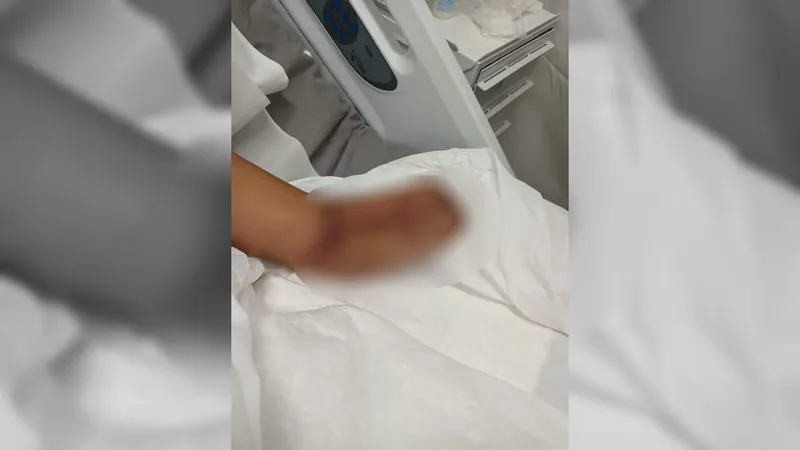 Mulher tem mão e punho amputados após parto em hospital particular