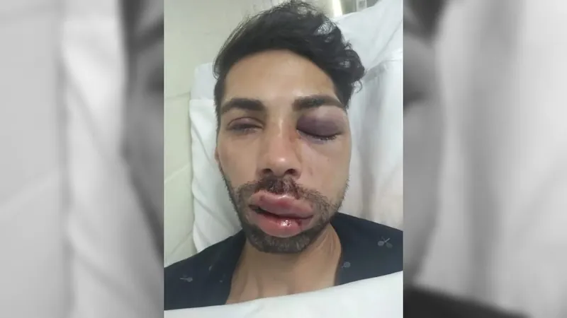 Justiça condena homem a nove anos de prisão por espancar Miss Drag Queen em SJC