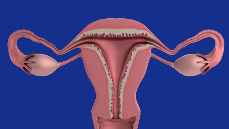 Câncer de ovário é considerado o tumor feminino mais perigoso