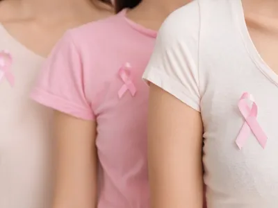 BRCA 1 e 2: conheça o exame que pode prever o câncer de mama