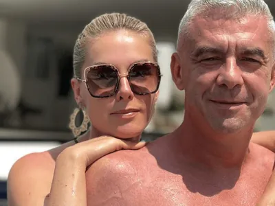 Ana Hickmann estaria 'muito machucada' após agressões do marido, diz site