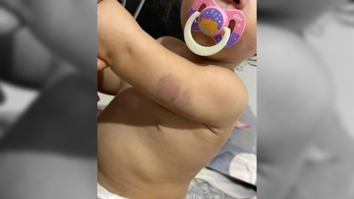 Polícia Civil investiga agressões sofridas por criança de 1 ano em creche