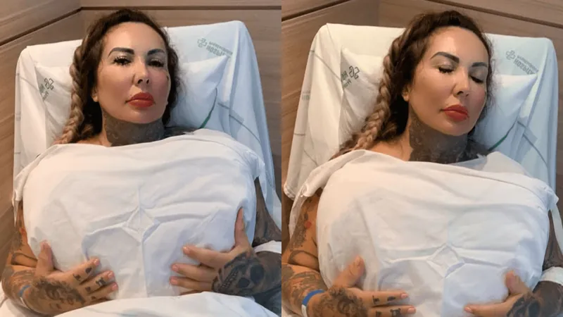 "Não vejo mais o umbigo", desabafa Sabrina Boing Boing após pôr 6l de silicone