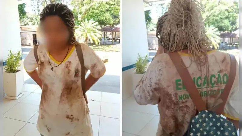 Menina negra é agredida e atingida por fezes de gato em escola de SP