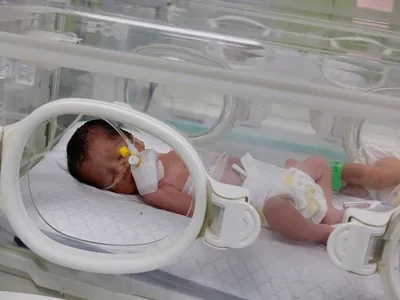 Morre bebê que foi salva do útero da mãe morta após ataque israelense em Gaza