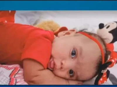 Bebê de 5 meses morre após ser atacada por cachorro em Goiás