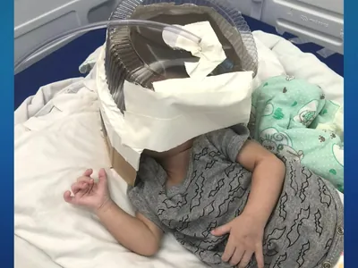 Hospital usa embalagem de bolo como máscara de oxigênio em bebê internado no RN