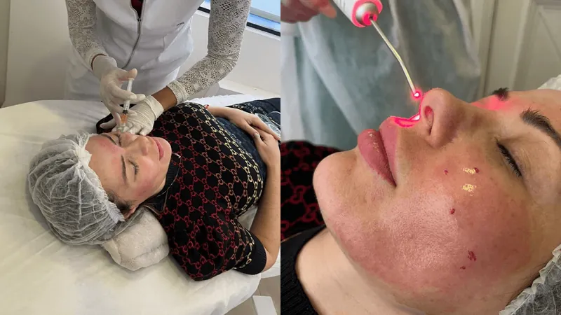 Ju Isen inicia tratamento facial com próprio sangue para atrasar envelhecimento