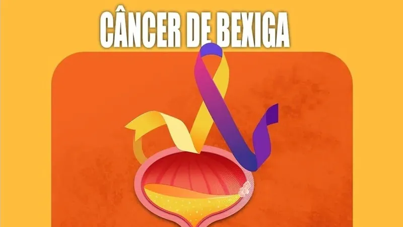 Câncer de bexiga: o que você precisa saber?