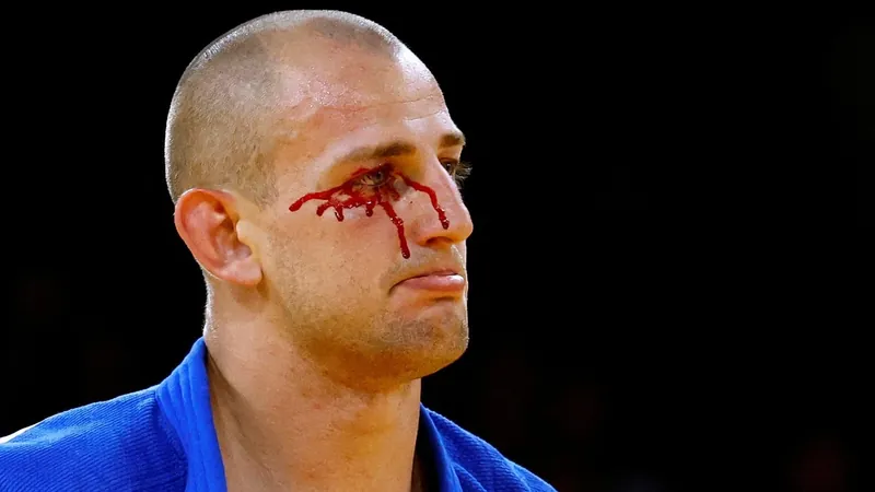 Judoca polonês perde luta, sofre ferimento e sai com olho sangrando em Paris