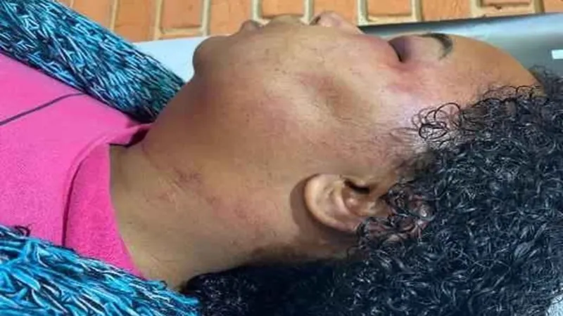 Homem é condenado a 2 anos de prisão por agressão a professora em Jacareí