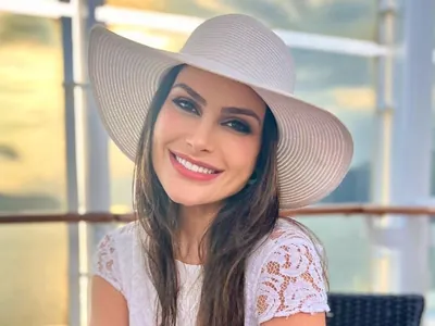 Miss Brasil relata momentos de desespero ao sofrer queimadura: “Susto”