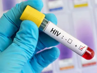 Paciente infectado com HIV após transplante é internado no Rio