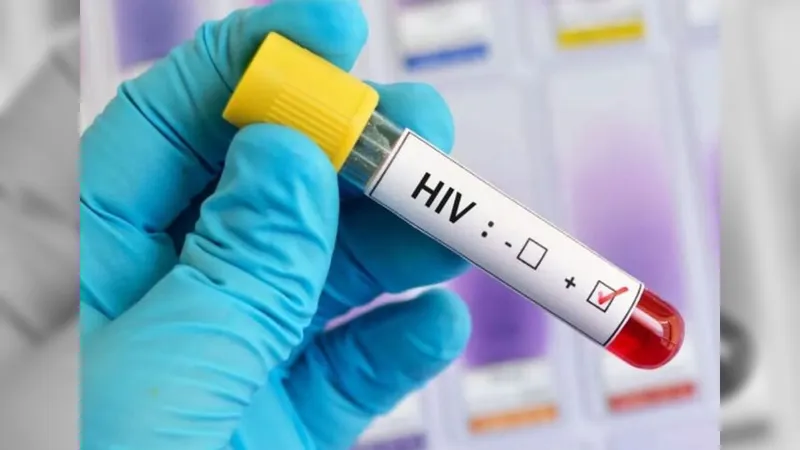 Paciente infectado com HIV após transplante é internado no Rio