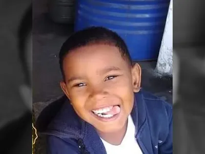 Menino de 8 anos que teve o braço reimplantado após acidente de ônibus recebe alta no Rio