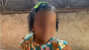 Menina de 3 anos é baleada na cabeça durante confronto em Belford Roxo