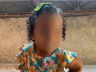 Menina de 3 anos é baleada na cabeça durante confronto em Belford Roxo