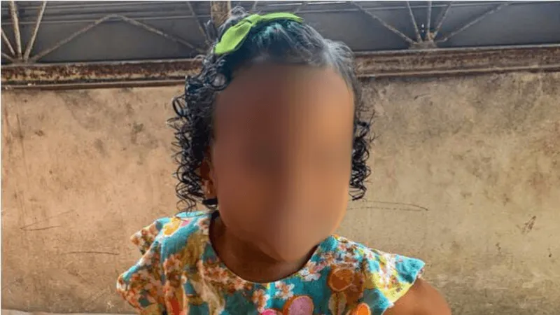 Menina de 3 anos é baleada na cabeça durante confronto em Belford Roxo