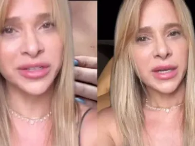 Dany Bananinha relata problema de saúde após complicações com silicone: "Dois enormes nódulos"