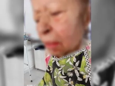 Técnica de enfermagem é flagrada agredindo idosa de 77 anos