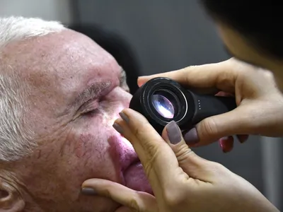 Mutirão para prevenção ao Câncer de Pele em Olímpia será no sábado (7)