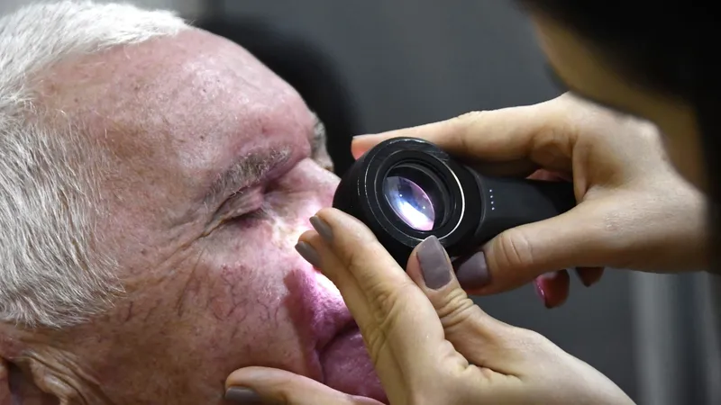 Mutirão para prevenção ao Câncer de Pele em Olímpia será no sábado (7)