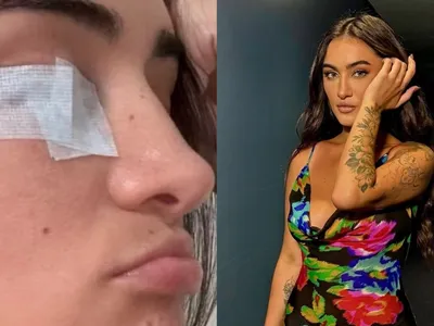 Gabi Melim é diagnosticada com doença que deixa face paralisada