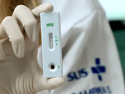 Campinas registra reduções de infecções por HIV e mortes provocadas pela aids