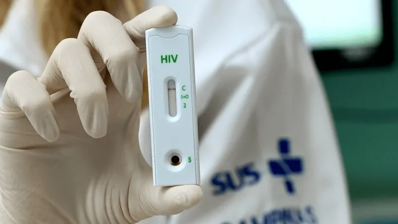 Campinas registra reduções de infecções por HIV e mortes provocadas pela aids